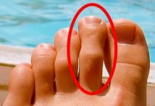 IMATE LI OVAKAV N0ŽNI PRST? Mnogima je ovo odvratno, A EVO KAKVU TAJNU KRIJE!