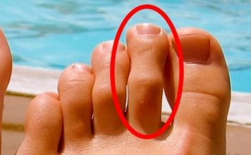 IMATE LI OVAKAV N0ŽNI PRST? Mnogima je ovo odvratno, A EVO KAKVU TAJNU KRIJE!