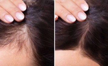 Zovu je “ŽIVA VODA”: Zaboravite skupe tretmane, ovo će zaustaviti opadanje kose i popraviti kosu – rezultati za 3 dana!