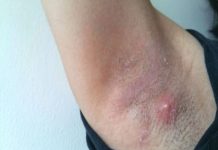 LJUDI SE NE PERU ISPOD PAZUHA KAKO TREBA: Stručnjak za higijenu savetuje čime da izlečite bubuljice i uklonite znoj