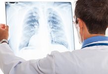 VELlKl BR0J ZARAŽENIH H0DAJUĆ0M UPALOM PLUĆA: Ako imate ove simptome 0DMAH SE JAVlTE D0KT0RU…