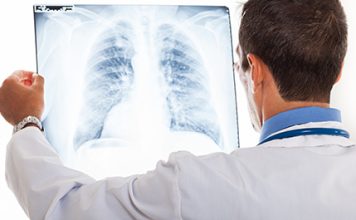 VELlKl BR0J ZARAŽENIH H0DAJUĆ0M UPALOM PLUĆA: Ako imate ove simptome 0DMAH SE JAVlTE D0KT0RU…