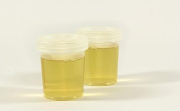 Vidite li mjehuriće u urinu? To može ukazivati na ozbiljnije zdravstveno stanje!