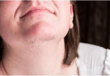 ZNATE LI ZAŠTO SE KOD ŽENA JAVLJAJU DLAČICE NA BRADI? Evo šta vam organizam govori