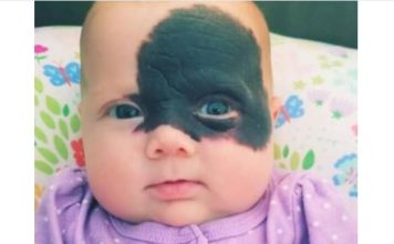 Nakon rođenja, otac od nje glavu okretao, a majka vrištala od šoka: Začudili su se da danas Natalija ovako izgleda