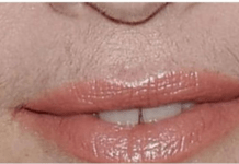 SVAKA ŽENA ZASLUŽUJE DA OVO ZNA: Prirodnim putem uklonite brkove i druge neželjene dlačice sa tijela zauvijek