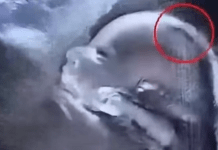 „Beba rođena s gustom kosom oduševila bolnicu – i celu zajednicu“