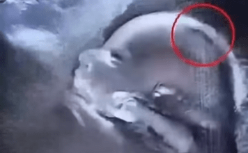 „Beba rođena s gustom kosom oduševila bolnicu – i celu zajednicu“