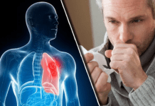 Nikad više nećete dobiti bronhitis i kašalj: Prirodni lek za decu i odrasle