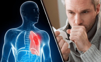 Nikad više nećete dobiti bronhitis i kašalj: Prirodni lek za decu i odrasle