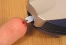 Najraniji znak da vam šećer razara organizam: Obratite pažnju na 1 opasan simptom