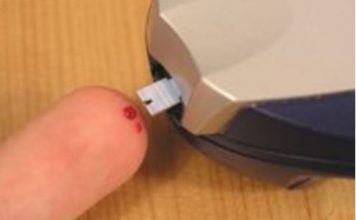 Najraniji znak da vam šećer razara organizam: Obratite pažnju na 1 opasan simptom