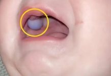 Majka je primetila nešto neobično u ustima svog devetomesečnog sina i odmah je otišla kod lekara — otkriće lekara bilo je iznenađujuće.