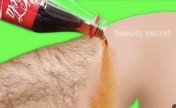 Prestanite se brijati! Ovo je najlakši način za uklanjanje dlačica s lica i tijela bez boli!