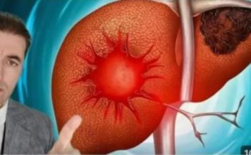 Evo kako se bolesna jetra pokazuje na koži,nogama? OVO SU SIMPTOMI BOLESNE JETRE…