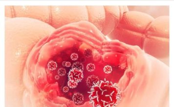 Ovo je prvi simptom RAKA CRIJEVA: Nisu hemeroidi, ako ovo primijetite, ODMAH IDITE DOKTORU – ne sramite se