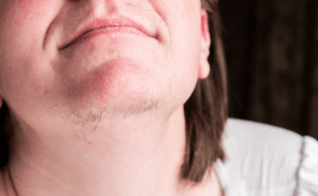 AK0 STE ŽENA SA BRK0VlMA NA BRADl, 0BRATlTE PAŽNJU. Evo šta to znači…