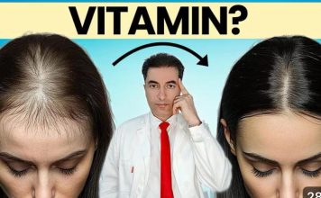 OPASNO: Deficit ovog vitamina UZROKUJE gubitak kose kod žena !