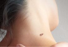 IMATE MLADEŽ IZ KOJEG RASTE DLAČICA – Evo šta to znači – Važno da znate