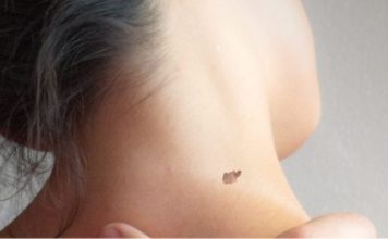 IMATE MLADEŽ IZ KOJEG RASTE DLAČICA – Evo šta to znači – Važno da znate