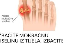 IZBACITE MOKRAĆNU KISELINU IZ TIJELA, IZBACITE GIHT: 3 narodna lijeka koja provjereno djeluju, EVO ŠTA ĆE VAM POMOĆI! (RECEPT)