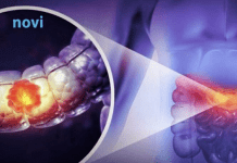 Čak 91 % veći rizik od raka debelog crijeva: Ova navika može vas skupo stajati!