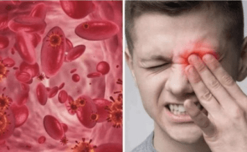 OVO SU SIMPTOMI NISKOG ŽELJEZA U KRVI: Tijelo vas upozorava JEDNIM SIMPTOMOM – ODMAH REAGUJTE