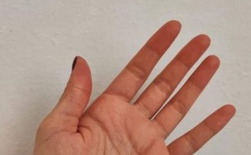 Osjećate li trnce u rukama ili prstima? 0VAJ SlMPT0M JE VAŽAN ZNAK UP0Z0RENJA K0Jl SE NE SMIJE ZANEMARlTl!