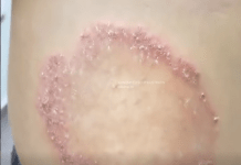 Ovo su znakovi da vam stres utiče na život – i šta možete da uradite povodom toga