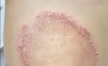 Ovo su znakovi da vam stres utiče na život – i šta možete da uradite povodom toga