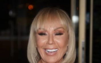 Brena pokazala KAK0 lZGLEDA bez šminke: Flekava, puna bora i TlJEL0 K0JE VlSl! OVO su slike bez filtera….