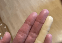 Ovo su posljedice spavanja sa…