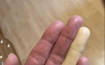 Ovo su posljedice spavanja sa…