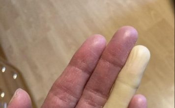 Ovo su posljedice spavanja sa…