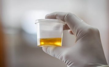 OSJETlTE Ll JAK MlRlS URlNA? To nije infekcija urinarnog trakta, već mnogo opasnije stanje koje IMATE…