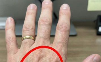 Ako imaš vidljive vene, to znači da si…😨😨‼️