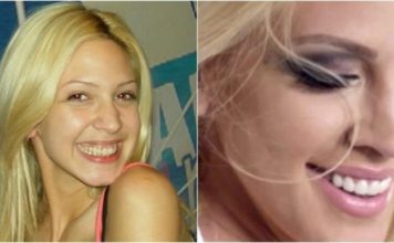 KAD SU SKUPILI PARE, URADILI SU ZUBE: POGLEDAJTE kako su izgledale domaće ličnosti PRIJE UMJETNIH ZUBA – CECA JE HIT (FOTO)