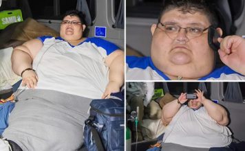 Najdeblji čovek težak skoro 600 kg izgubio je polovinu svoje težine: ovako sada izgleda.