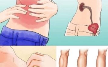 KAD SA BUBREZIMA NIJE SVE U REDU, TIJELO ŠALJE OVE SIGNALE: 6 Simptoma koje ne smijete ignorisati!