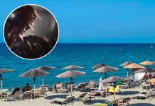 Dečak iz Srbije zgazio otrovno stvorenje na plaži u Grčkoj: “Toliko boli i brzo otiče da ne mogu da vam opišem”
