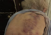 Vratila sam se kući kako bih pomogla svojoj starijoj majci da se okupa. Čim sam posegnula prema njoj, trgnula se kao da ću je udariti.