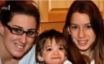 Ova devojčica uopšte nije starila, sa 20 godina sve je frapirala izgledom: Dok su lekari pokušavali da shvate šta se dešava, roditelji povukli šok potez