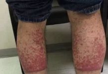 OVO SU POSLJEDICE SPAVANJA SA… ŠTA SE ZAISTA DEŠAVA POSLIJE….