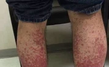 OVO SU POSLJEDICE SPAVANJA SA… ŠTA SE ZAISTA DEŠAVA POSLIJE….