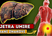 DA LI JE VAŠA JETRA U OPASNOSTI? Ovo je 12 ranih znakova ciroze jetre koje ne smete da ignorišete