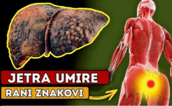 DA LI JE VAŠA JETRA U OPASNOSTI? Ovo je 12 ranih znakova ciroze jetre koje ne smete da ignorišete