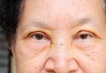 Voćka broj 1 protiv h0lesterola, pritiska I moždanog udara: ko je jede, bit će zdrav kao drijen